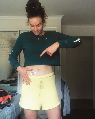 Lara wearing Dexcom G6